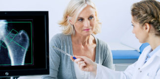 Osteoporosi, aumentano pazienti e costi osteoporosi