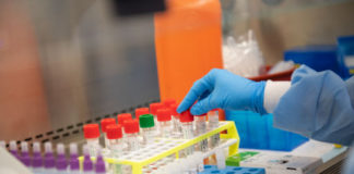 Con la piena ripresa dell’attività anche negli altri laboratori della città e della provincia e con l’ampliamento del servizio, grazie alla disponibilità di alcune strutture private, entro oggi sarà smaltito l’arretrato dei tamponi rino-faringei