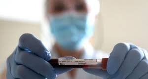 “Il PD all’Ars chiede di istituire una commissione parlamentare di indagine sulla gestione dell’emergenza Covid-19 in Sicilia e sui dati relativi al numero dei soggetti positivi”