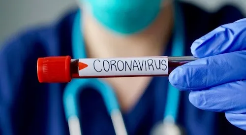 Corona-Virus