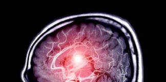 È stato il tempo, in tutti i sensi, a salvare la vita di un crocerista giunto nei giorni scorsi presso l’azienda ospedaliera universitaria di Messina a seguito di un malore