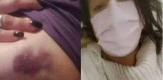 Una donna di Monfalcone (Gorizia), Monica Bizaj, 48 anni, è stata aggredita, la vigilia di Pasqua, da cinque persone mentre si trovava all’esterno di un locale cittadino, per aver difeso un’amica da pesanti molestie