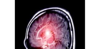 Visite riabilitative gratuite per chi ha subito un ictus cerebrale o un trauma cranico: anche l’UOC di Medicina Fisica e Riabilitativa dell’AOU G. Martino di Messina, diretta dal prof. Daniele Bruschetta, aderisce alla settimana di screening promossa in tutte le aziende ospedaliere universitarie della regione e che vede come capofila l’AOU Policlinico G. Rodolico S. Marco di Catania