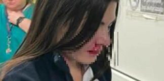 Ancora un’aggressione ai danni di un operatore sanitario: stavolta la vittima è un’infermiera dell’ospedale San Leonardo di Castellammare di Stabia (Napoli)