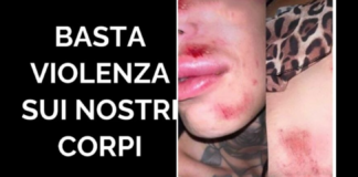 “È di poche ore fa la notizia di un’aggressione transfobica estremamente violenta avvenuta a danno di due donne trans in una piazza di Castiglione in Teverina, in provincia di Viterbo, durante una festa di paese… ‘siamo state aggredite da un branco di ragazzi, il più grande avrà avuto 20 anni… l’unica domanda che si facevano le pecore era capire se fossimo donne o trans… dopo aver chiamato i carabinieri e la sicurezza nessuno è stato in grado di fermare mezzo cogl… del branco, soffermandosi sul fatto che avevamo un aspetto provocatorio’… questo è quanto riportato dalle due ragazze ai media”