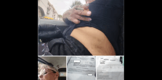 ‘È stata presa a calci e pugni, anche quando era inerme sul pavimento, dal fratellastro e sua moglie: Un dramma familiare che va avanti da anni di cui ne è vittima una donna napoletana trasferitasi a Mugnano, nell’hinterland dell’area Nord, da qualche anno… la donna ed il suo carnefice hanno avuto padri diversi ma la stessa madre- oggi con gravi problemi salutari- ed è su di essa che si sono concentrate le attenzioni dell’uomo’