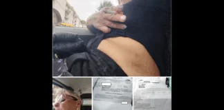 ‘È stata presa a calci e pugni, anche quando era inerme sul pavimento, dal fratellastro e sua moglie: Un dramma familiare che va avanti da anni di cui ne è vittima una donna napoletana trasferitasi a Mugnano, nell’hinterland dell’area Nord, da qualche anno… la donna ed il suo carnefice hanno avuto padri diversi ma la stessa madre- oggi con gravi problemi salutari- ed è su di essa che si sono concentrate le attenzioni dell’uomo’