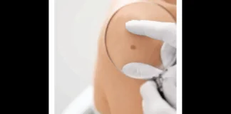 L’UOC di Dermatologia dell’AOU Policlinico «Gaetano Martino» di Messina (diretta dal Prof. Fabrizio Guarneri), anche quest’anno parteciperà all’iniziativa «Save your skin», prevista per sabato 24 Maggio, dalle 9 alle 13: in tale occasione sarà possibile ricevere consulti e visite gratuite; è necessario prenotare tramite il call center dedicato, operativo dal 5 Maggio, 7 giorni su 7, dalle 08.30 alle 19.30, al numero 800 991126